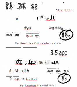 Karyotype of normal Male